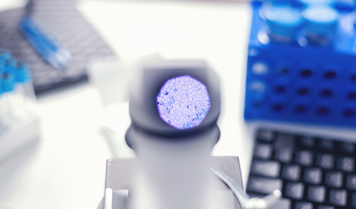 Genetic Screening of Embryos